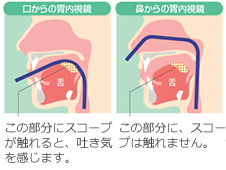 gastroscope 07